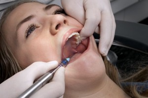 Regional nerve block
