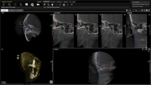 Tomografia laryngologiczna Tomografia dentystycznai laryngologiczna Poznań
