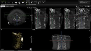 Tomografia kregosłup szyjny Tomografia dentystycznai laryngologiczna Poznań